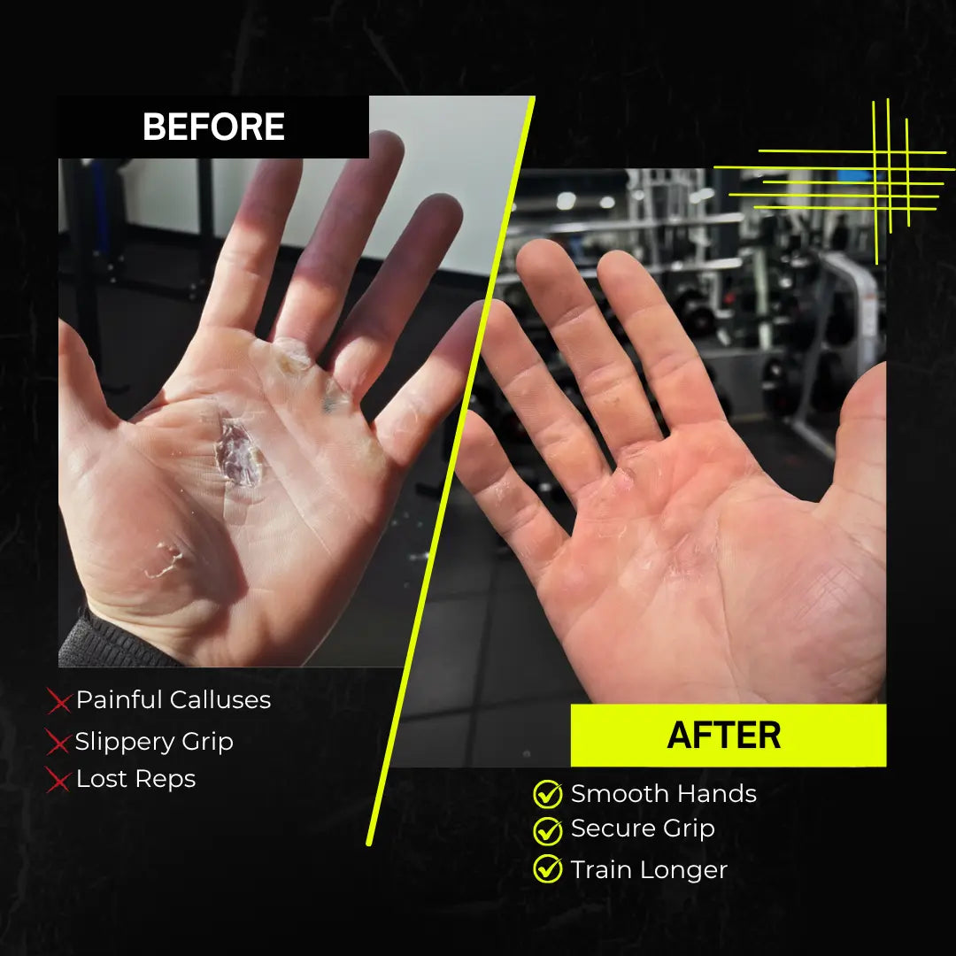 OCTOGRIPS™ I Workout Grip